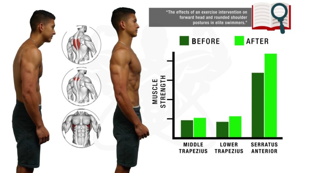 2010 clinical trial showing strengthening of underactive muscles help with improving hunchback posture