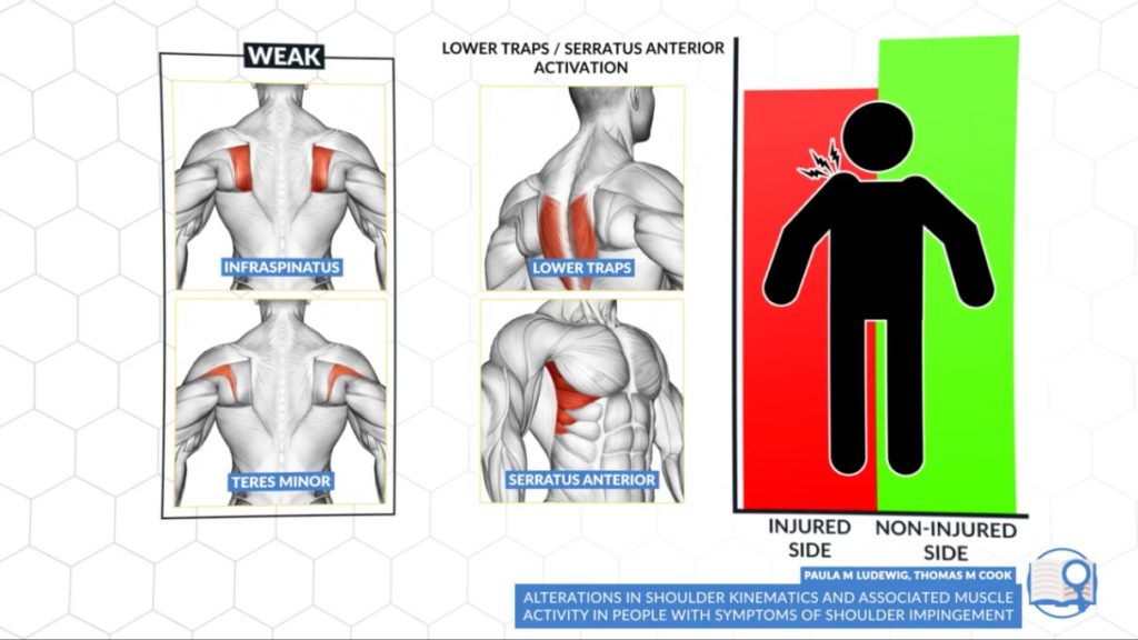 Shoulder impingement muscle imbalances