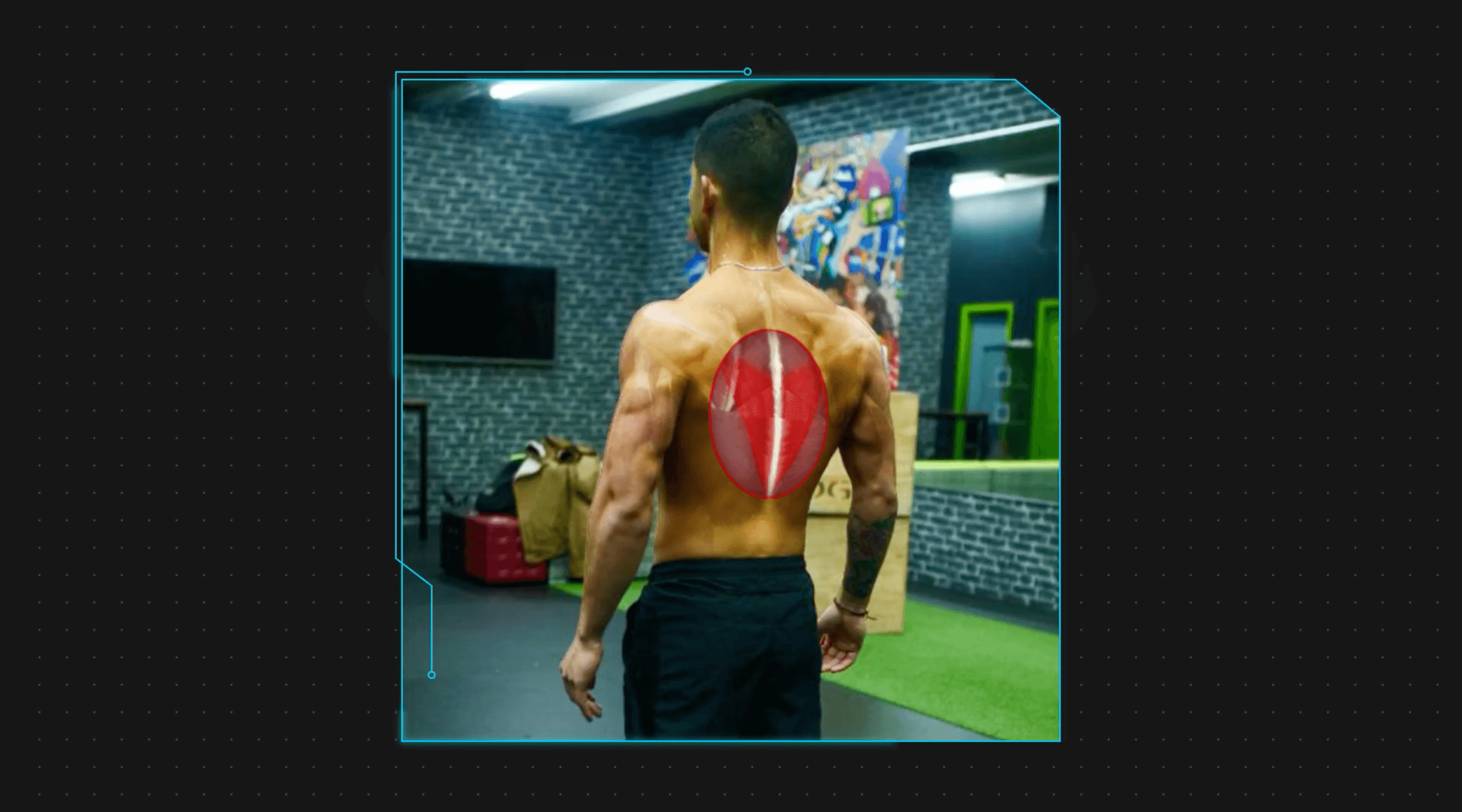 Muscle imbalance back lower traps