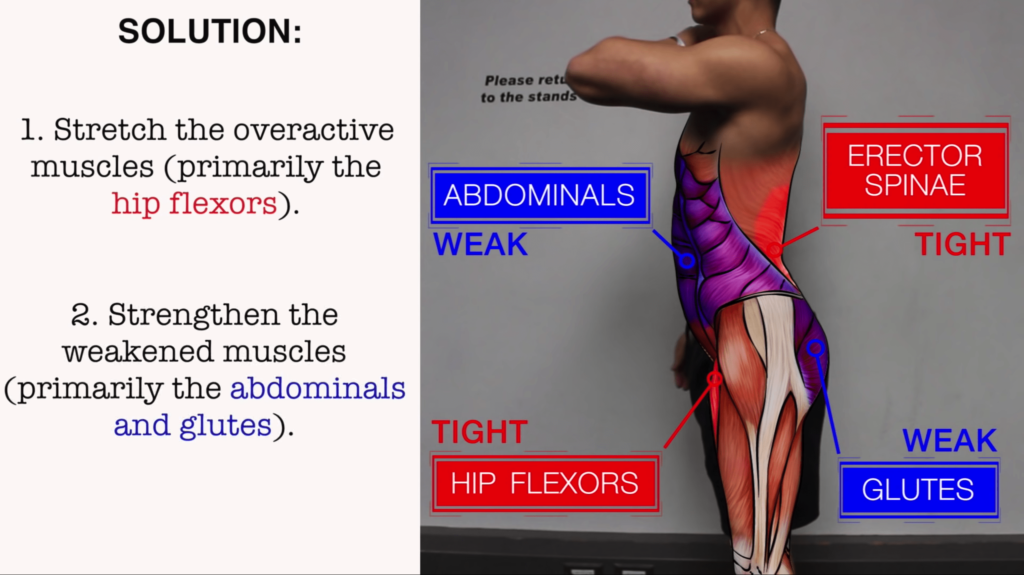 Solution to anterior pelvic tilt-min