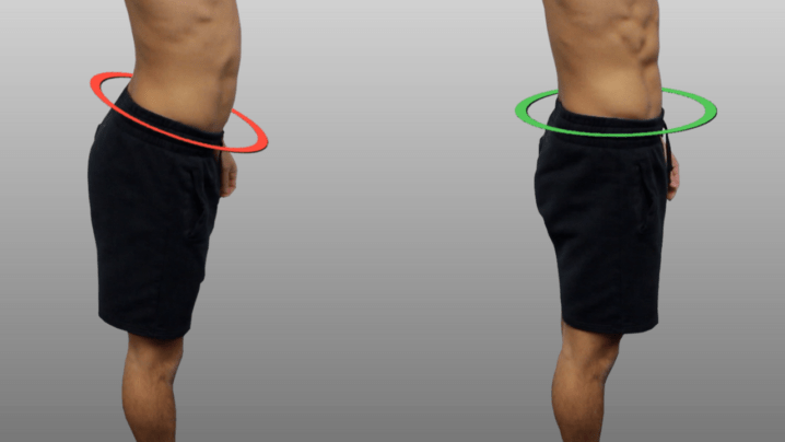 what is anterior pelvic tilt